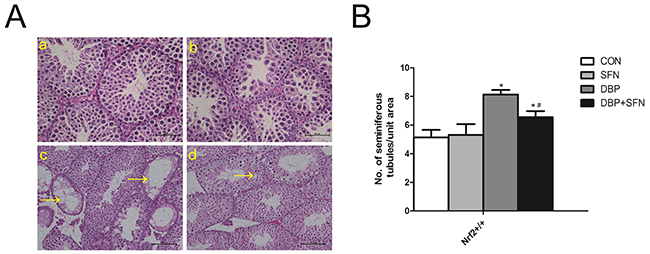 SFN prevents DBP-induced testicular oxidative stress injury in testicular morphology.