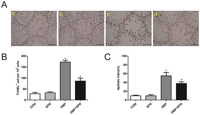 SFN decreases the number of TUNEL positive cells in response to DBP (&#x00D7;400).