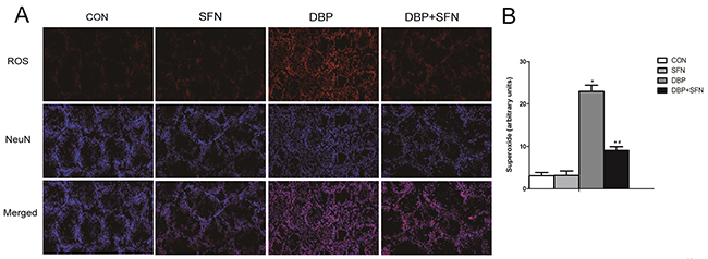 Effect of DBP stimulation and SFN supplementation on ROS generation.