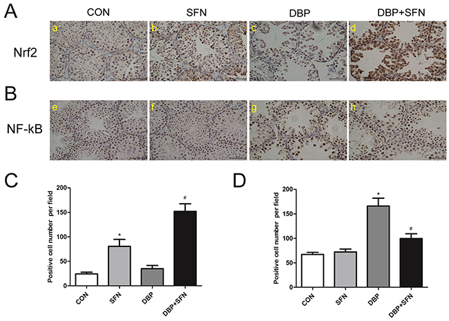 SFN supplementation influences expression levels of Nrf2 and NF-&#x03BA;B in immunohistochemical staining.