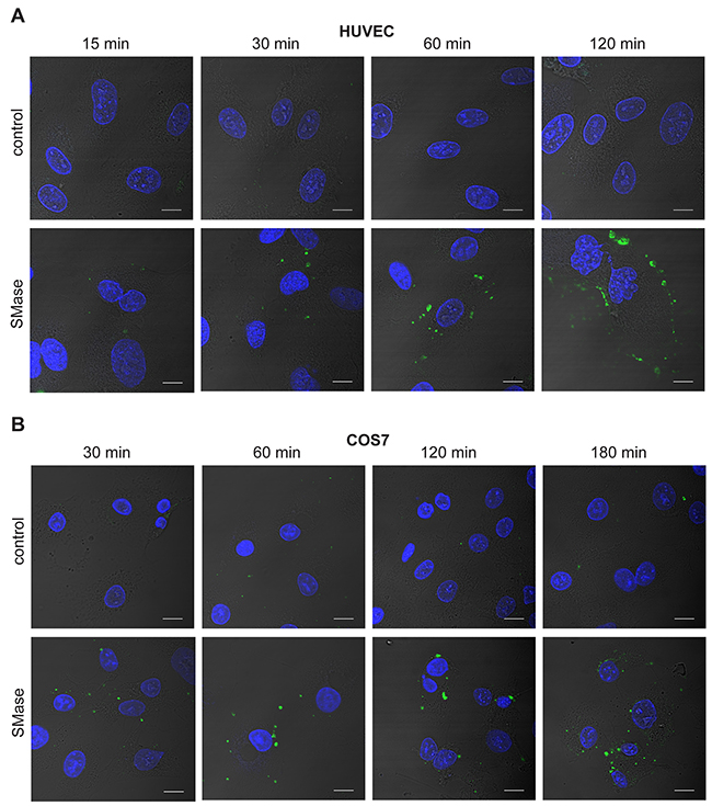 SMase stimulation induces phosphatidylserine exposure in HUVEC and COS7 cells.