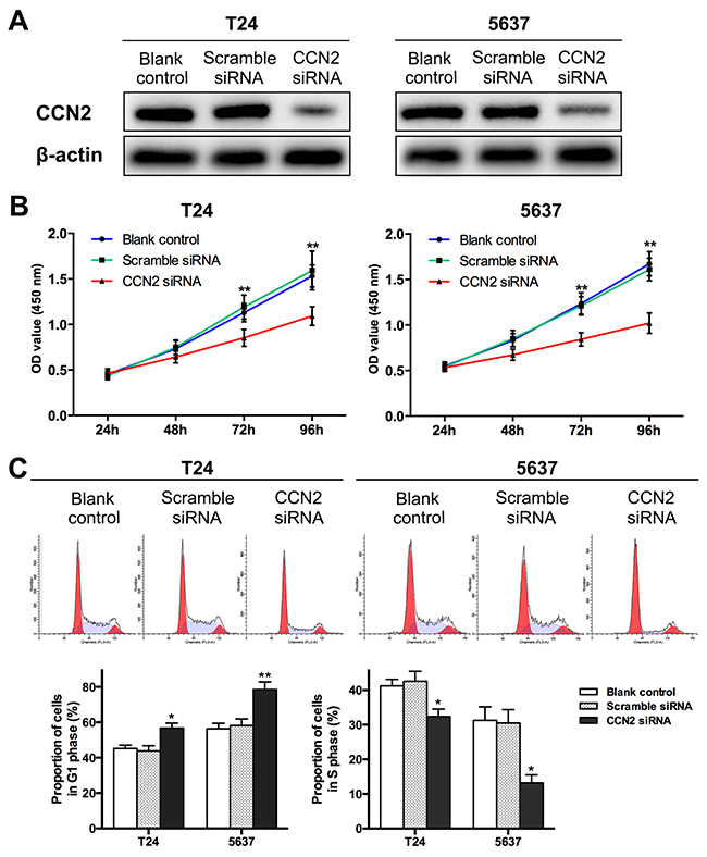 Down-regulation of CCN2 suppresses proliferation of UBC cells.