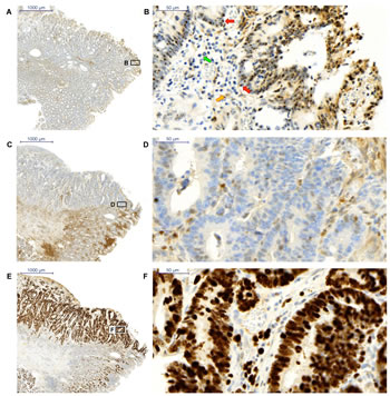 Immunohistochemistry staining of