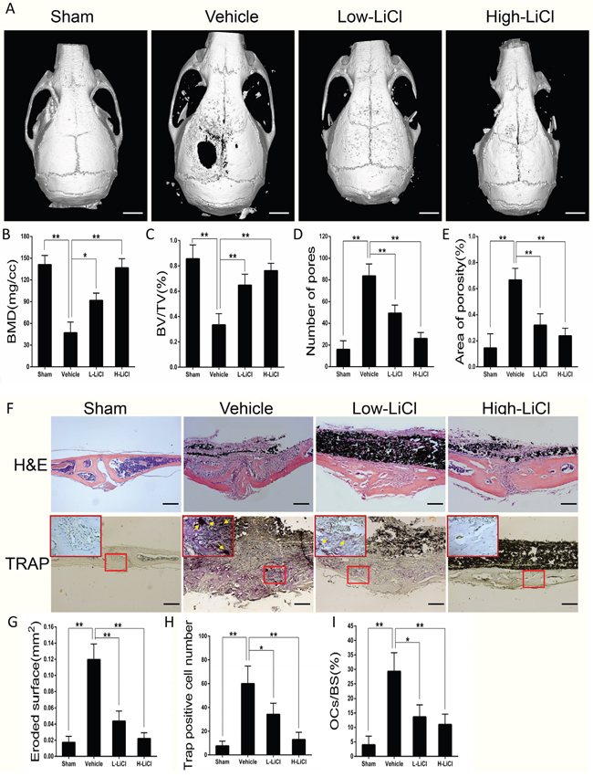 LiCl alleviated inflammatory responses and suppressed bone loss stimulated by Ti particles in a calvarial osteolysis model.