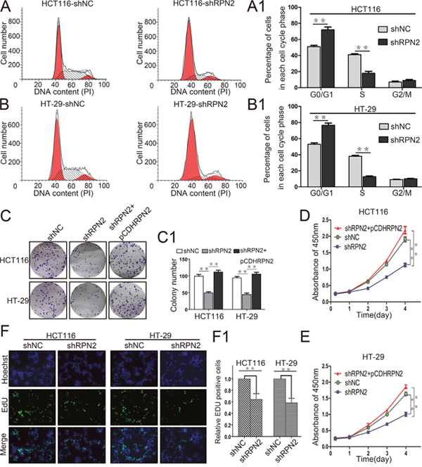 RPN2 knockdown inhibits colorectal cancer cell proliferation and cycle progression in vitro.