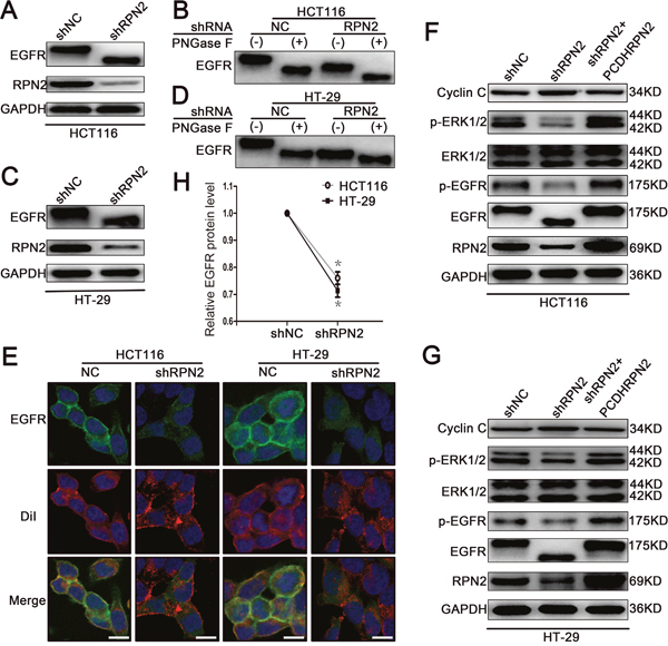 RPN2 silencing regulates glycosylation of EGFR and EGFR/ERK signaling pathway.