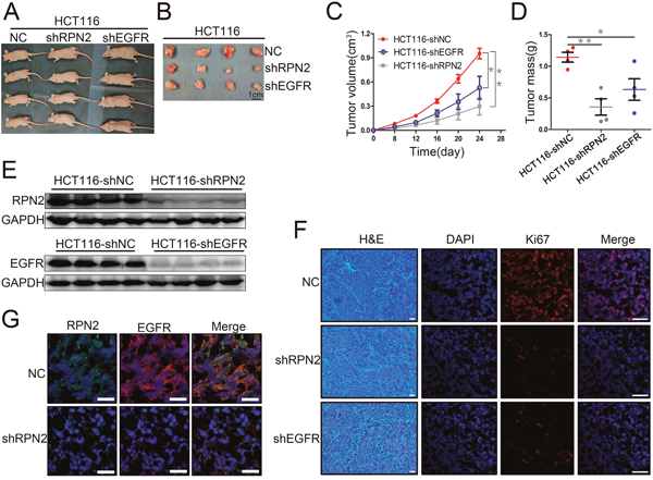 RPN2 or EGFR knockdown suppressed xenograft tumors growth in nude mice.