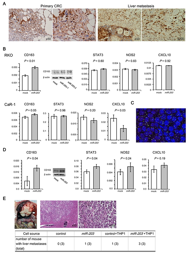Effect of miR-203 on the differentiation of monocytes to M2 macrophages and the metastatic potential of CRC cells.