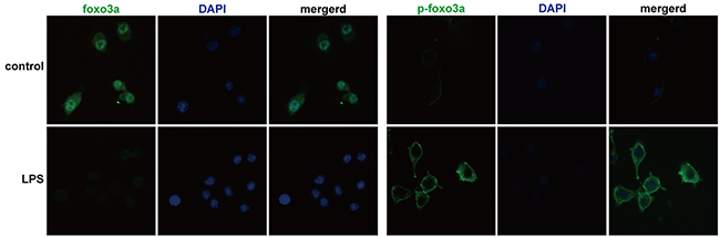 Foxo3a and p-Foxo3a levels in PBMCs were detected by immunofluorescence assay.