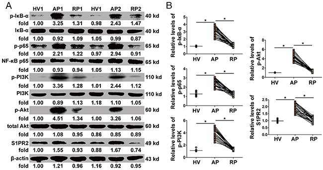 Activation of NF-&#x03BA;B and PI3K/Akt pathways in PBMCs.
