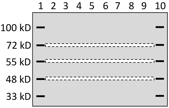 Depiction of gel stripe excision.