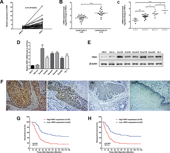 VRK1 is overexpressed in ESCC and correlated with the clinical outcome of ESCC patients.