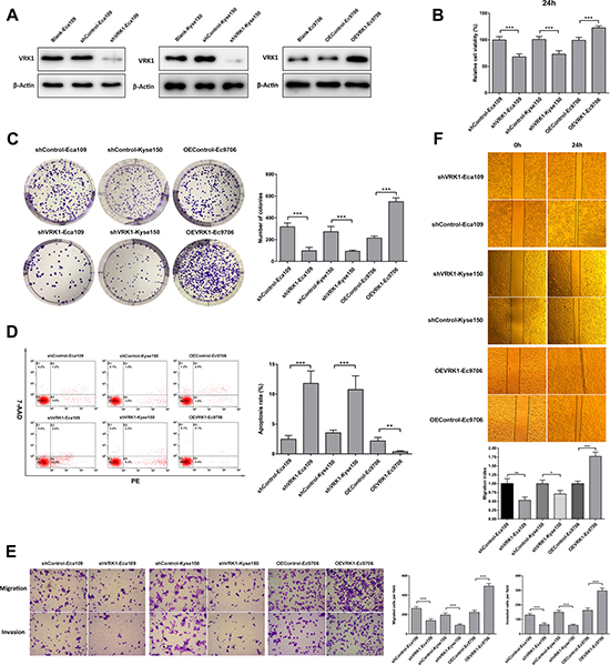 VRK1 is essential for the proliferation, survival, migration and invasion of ESCC cells.