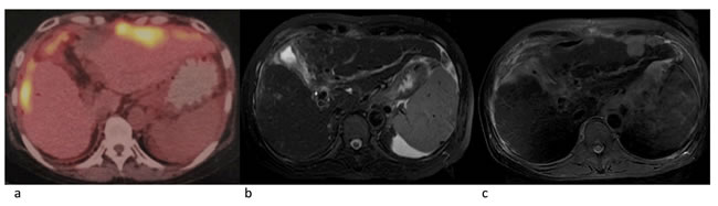 Radiographies of a 54-year old female patient.