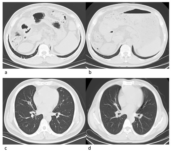 Radiographies of a 43-year old male patient.