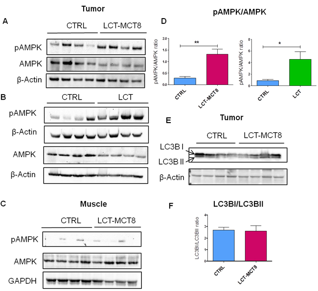 Western blot analysis of SK-N-BE(2) xenografts showed energy stress and lack of autophagy in LCT-MCT8 group compared to CTRL.