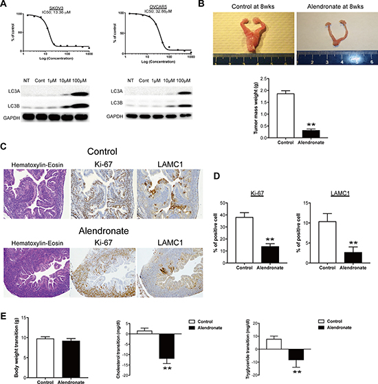 Bisphosphonate-mediated anti-tumor effect in vitro and in vivo.