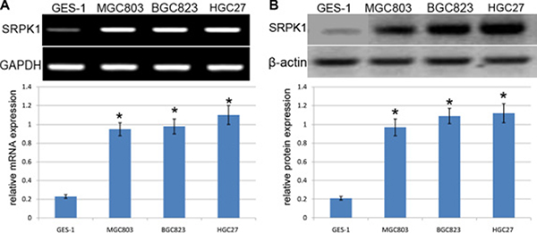 Analysis of SRPK1 expression in GC cell lines.