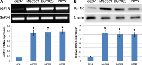 Analysis of IGF1R expression in GC cells.
