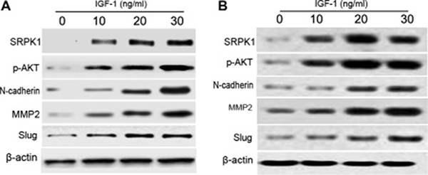IGF-1 induces the expression of p-AKT and EMT in MGC803 and BGC823 cells.