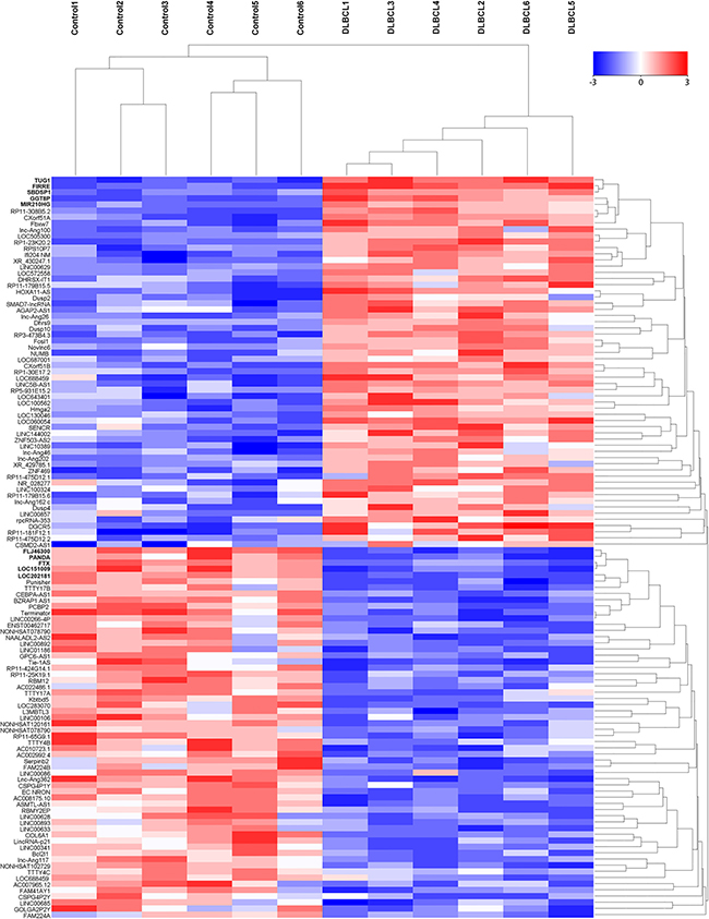 The heat map shows expression of the 120 lncRNAs most up- or down-regulated in DLBCL patients compared with healthy controls.