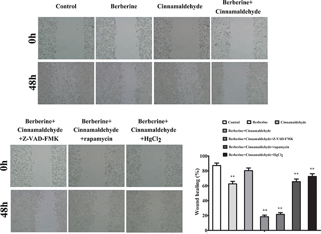 Berberine and cinnamaldehyde together suppressed wound healing in A549 cells.