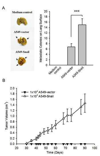 Overexpression of Snail enhances in vivo metastatic and tumorigenic abilities in A549 cells.