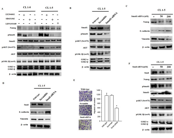 The Smad1/Akt/GSK3&#x3b2; pathway is consistently activated in CL1-5 cells but is downregulated in Snail-silenced CL1-5 cells.