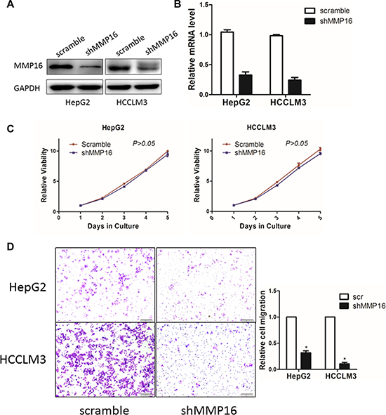 The effect of MMP16 on HCC cell proliferation and invasion.