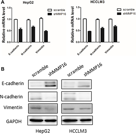 MMP16 promotes epithelial-mesenchymal transition in HCC.