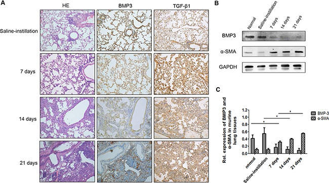 Expression of BMP3 and TGF-&#x03B2;1 protein in fibrotic lungs of the bleomycin-induced murine model of pulmonary fibrosis.