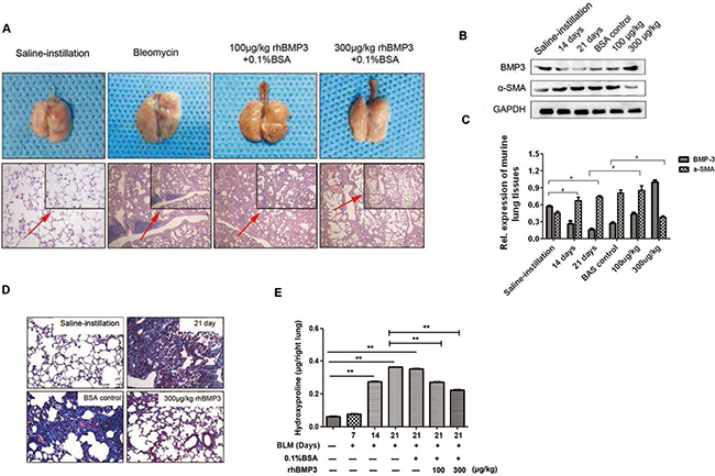 Reduced expression of BMP3 contributes to the development of pulmonary fibrosis and predicts the unfavorable prognosis in IIP patients