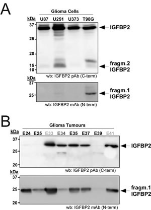 Relevance of IGFBP2 cleavage in gliomas.