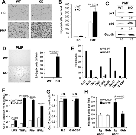 KO-peritoneal membrane fibroblasts (PMF) express increased Cxcl10 levels.