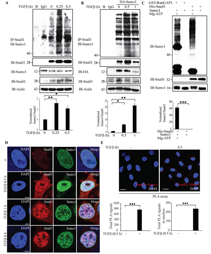 TGF&#x3b2; stimulates sumoylation of Snail1.