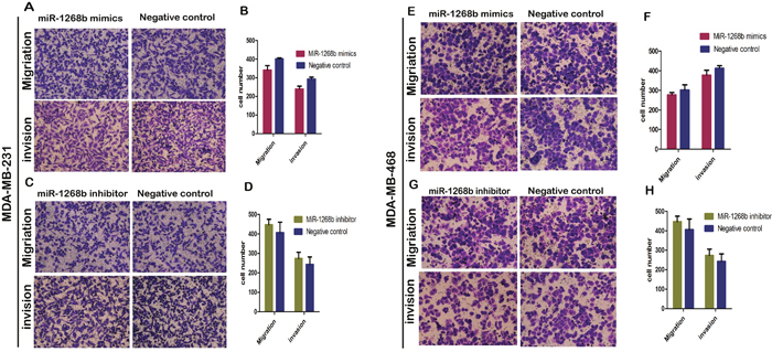 Transwell assay revealed that miR-1268b had no effect on migration or invasion ability of breast cancer.