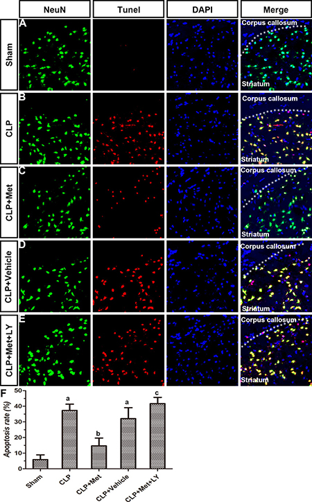 Effect of metformin on neuronal apoptosis in striatum using TUNEL assay and immunohistochemistry.