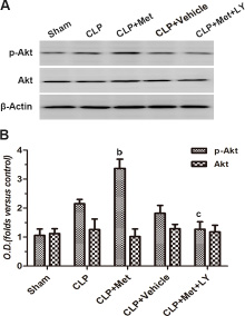 Effect of metformin on phosphorylation of Akt protein.