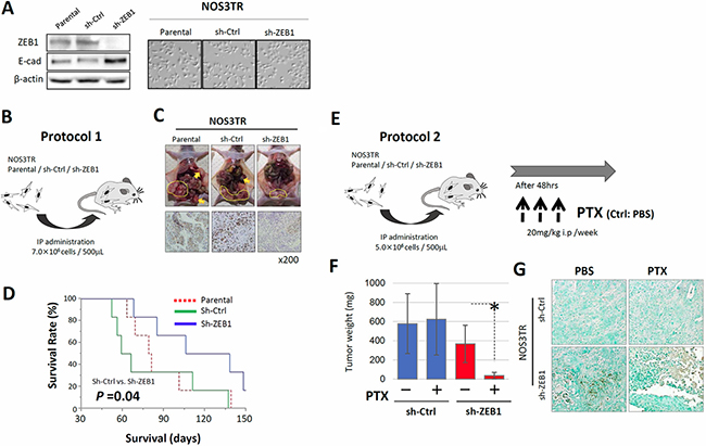 ZEB1 is required for chemo-resistance to PTX in vivo.