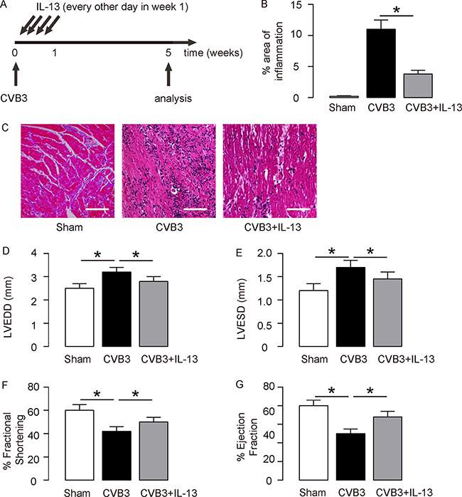 IL-13 protects mouse heart function in coxsackie virus B3 (CVB3)-induce myocarditis.