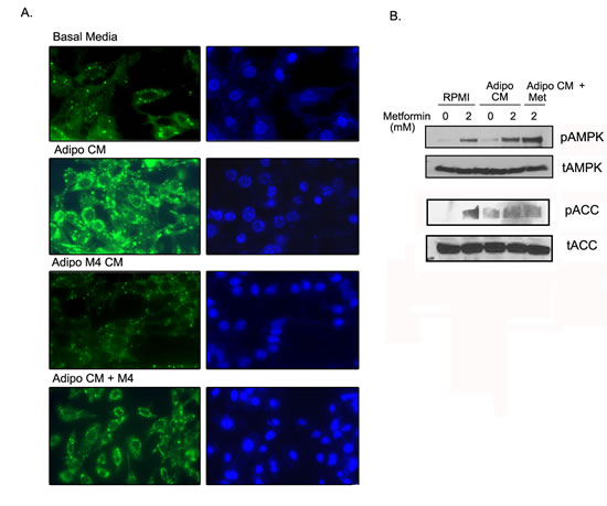 FIGURE 5: Metformin inhibited adipocyte mediated lipid accumulation in ID8 cells.