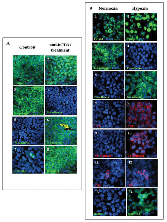 Figure 6; Expression of EMT proteins in orthotopic NB tumors from hCD31 mAb treated mice and in human NB cell lines incubated