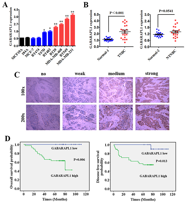 GABARAPL1 was up regulated and correlated with poor clinical outcomes in TNBC.