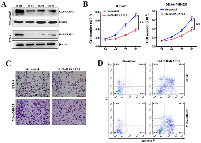Inhibition of GABARAPL1 suppressed cell proliferation and invasion, induced cell apoptosis in TNBC.