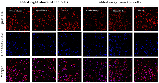 The cell uptake of different dyestuff added methods for free NR, 30 nm NR-lip, and 100 nm NR-Lip with CLSM.