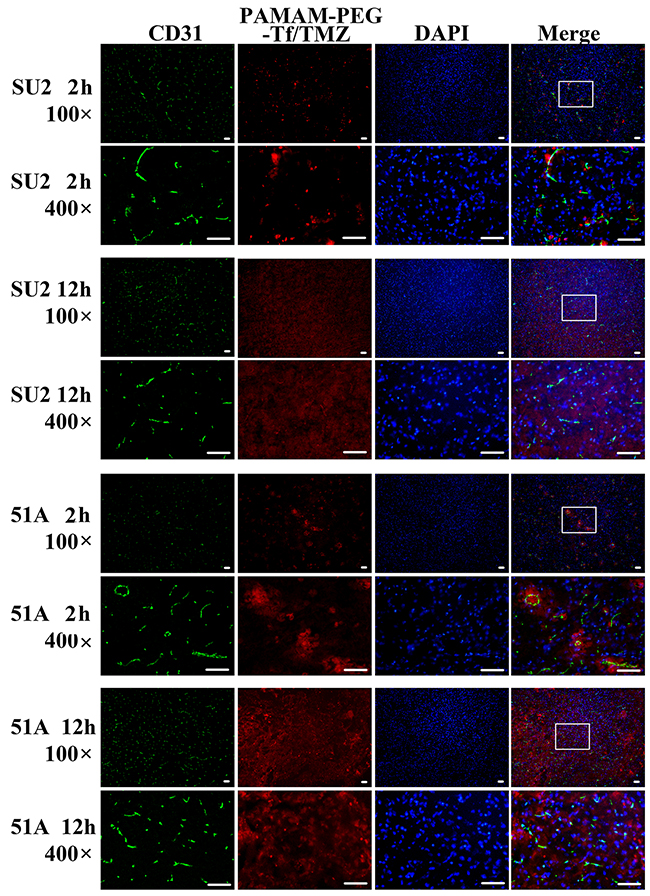 BBB permeability of PAMAM-PEG-Tf/TMZ in tumor-bearing mice.