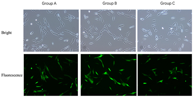 Comparison of VSMCs transfected with OPG overexpression and interference lentiviral vectors.