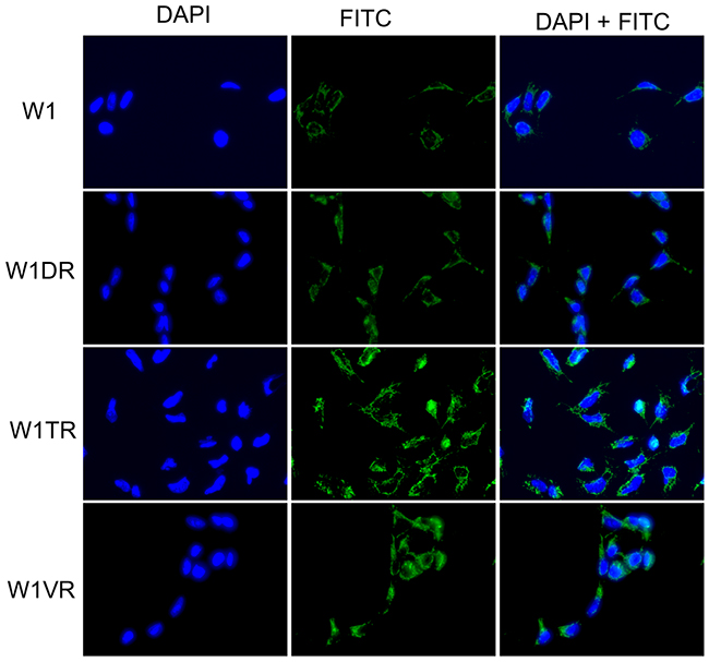 Immunofluorescence visualization of LUM expression in the W1, W1DR, W1TR and W1VR cell lines.