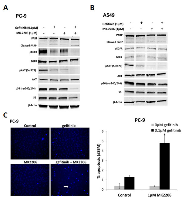 The effect of combining gefitinib and MK2206 on EGFR downstream signaling and apoptosis of NSCLC cells.