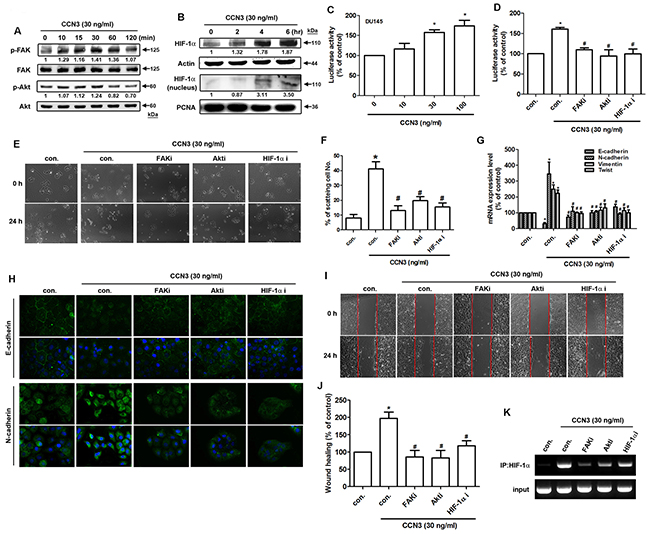 CCN3 triggers FAK/Akt/HIF-1&#x03B1; pathway to induce Twist expression and promotes EMT in PCa cells.